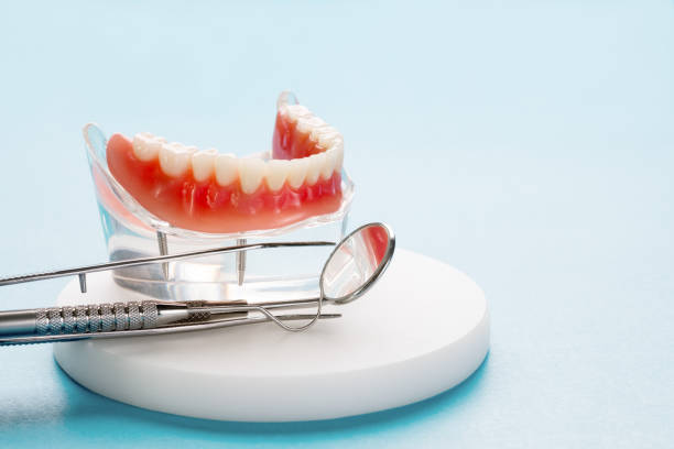 Full Mouth Reconstruction in Fredericktown, OH
