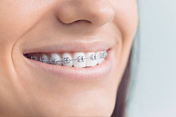 Best Root Canal Treatment  in Fredericktown, OH